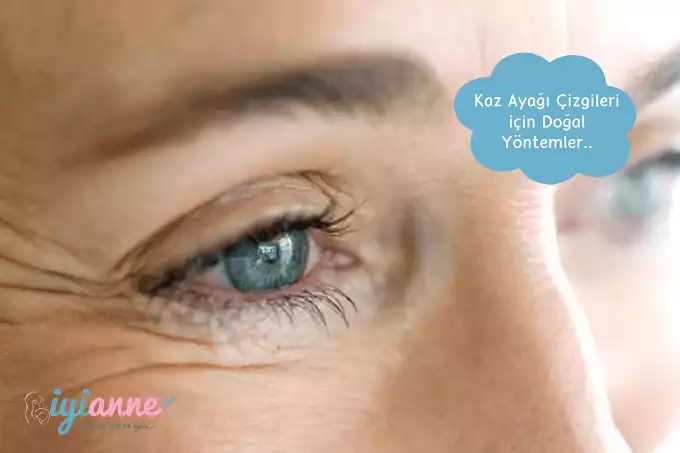 Kaz Ayağı Çizgileri için Doğal Yöntemler