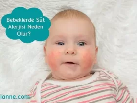 Bebeklerde Süt Alerjisi Neden Olur?